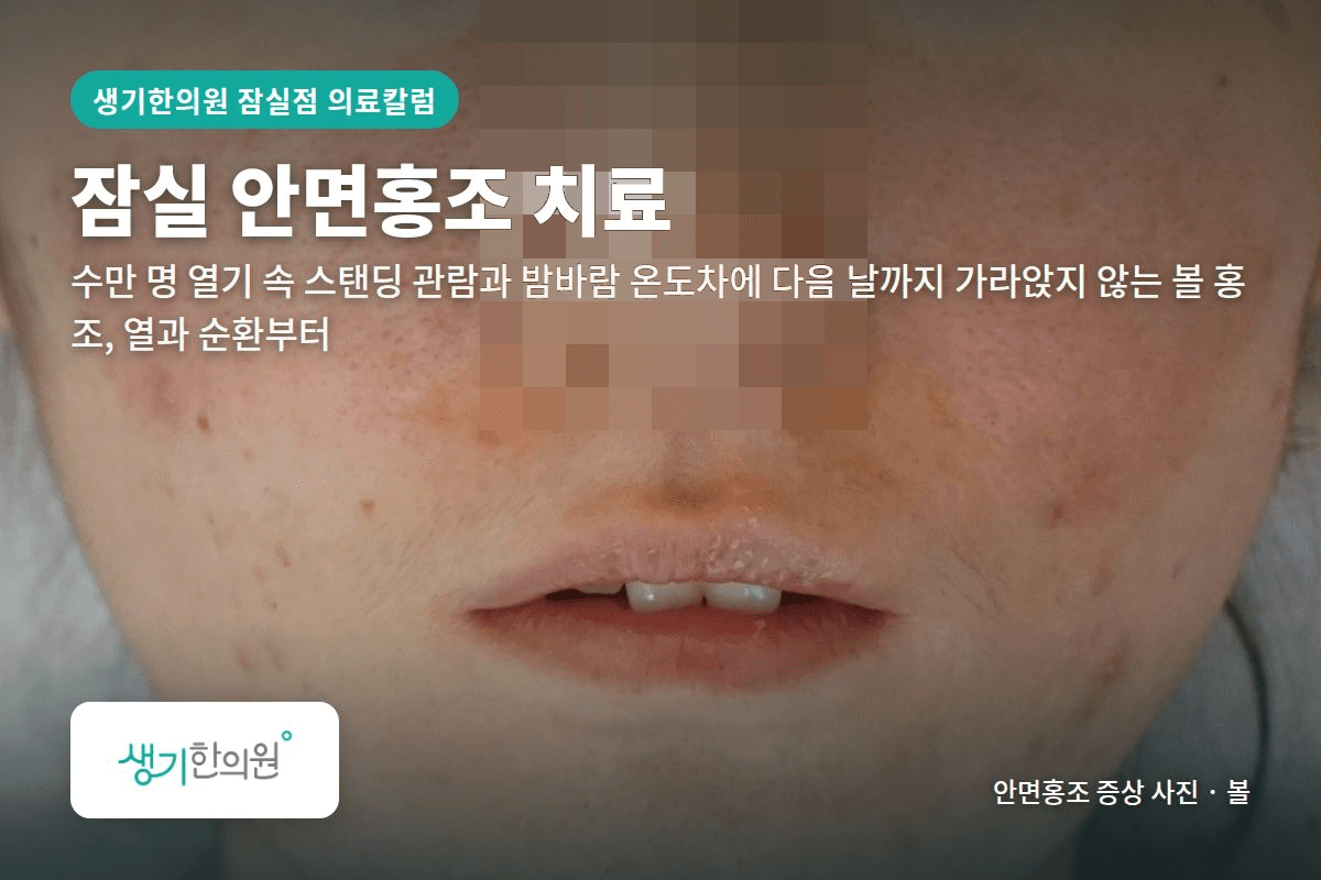 볼 안면홍조 증상 사진과 문구 「잠실 안면홍조 치료, 수만 명 열기 속 스탠딩 관람과 밤바람 온도차에 다음 날까지 가라앉지 않는 볼 홍조, 열과 순환부터 · 생기한의원 잠실점」